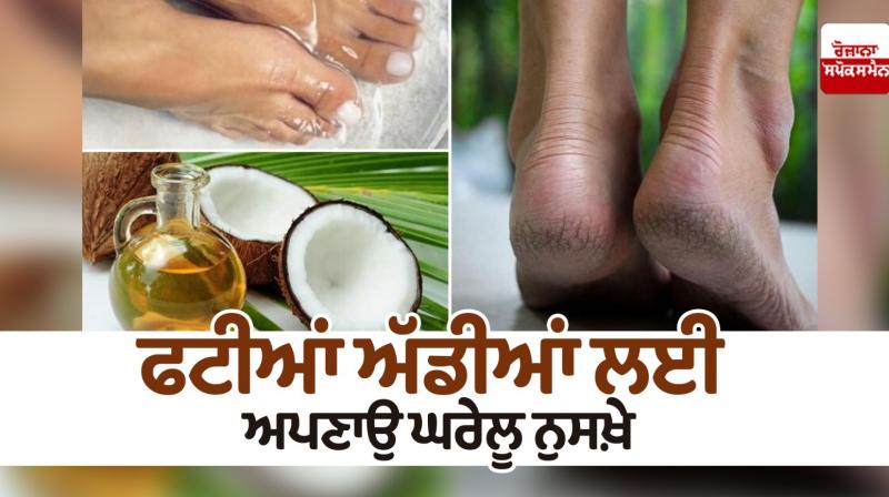 Follow home remedies for cracked heels Follow home remedies for cracked heels