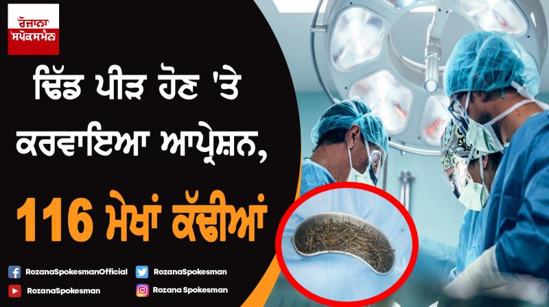 116 Iron Nails, Wire Removed From Man's Stomach In Rajathan's Bundi 116 Iron Nails, Wire Removed From Man's Stomach In Rajathan's Bundi