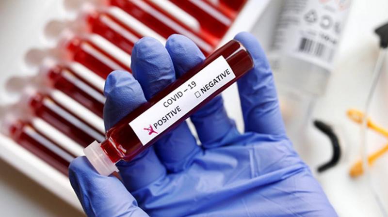 Corona Virus Corona Virus