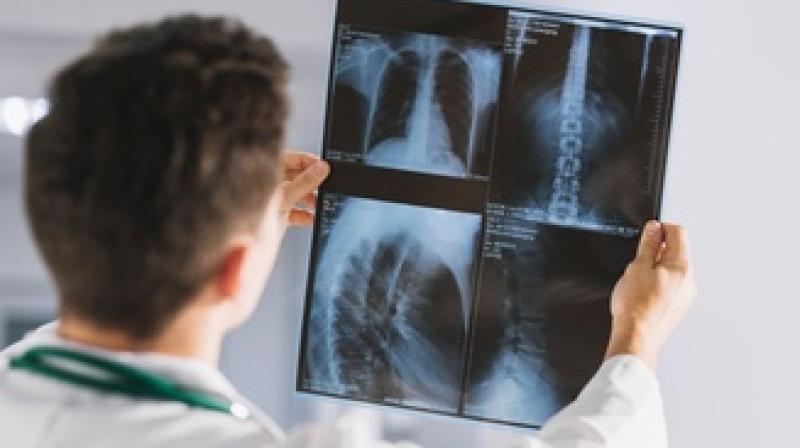 xRAY xRAY
