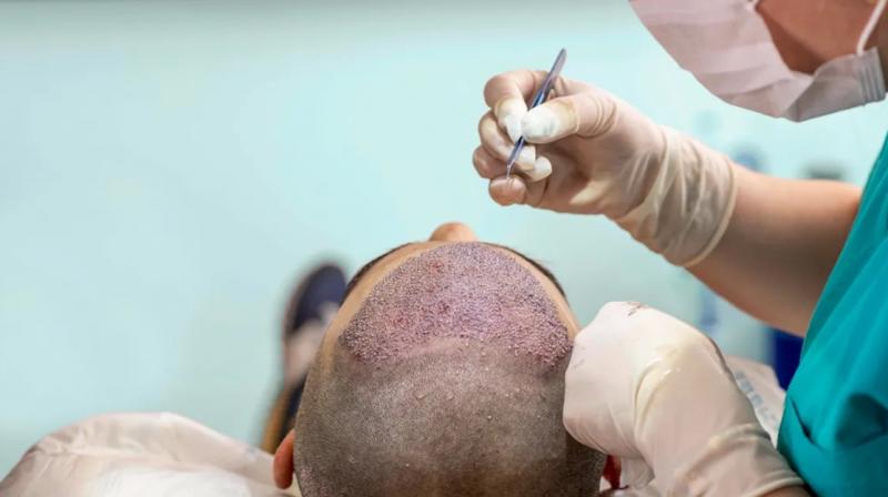 Dentists are treating baldness, death is happening, appearance is distorted Dentists are treating baldness, death is happening, appearance is distorted