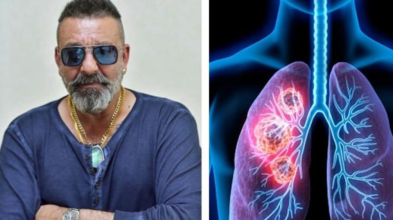 Sanjay Dutt Sanjay Dutt