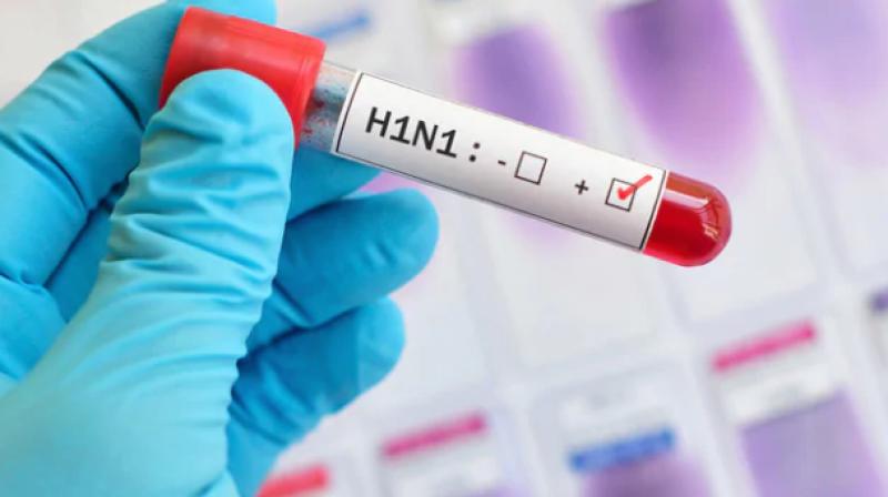 Swine Flu Swine Flu