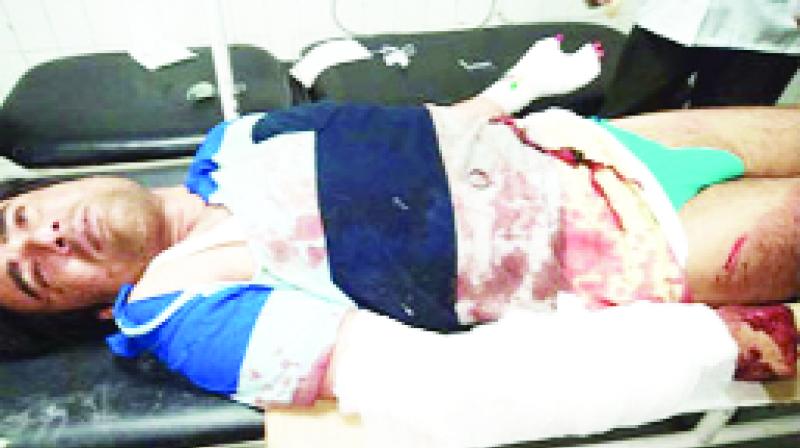 Pulkit In Serious Condition Injured Pulkit In Serious Condition Injured