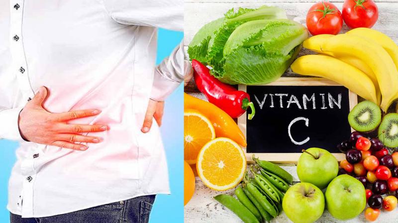 Kidney stones and  vitamin C