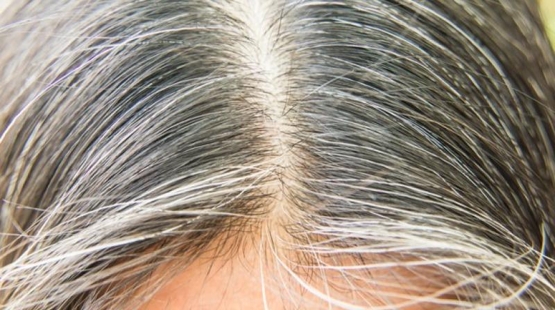  Are you also tired of the problem of white hair at a young age?