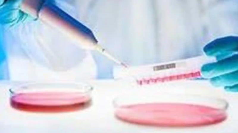 USA: First case of monkeypox detected in Texas USA: First case of monkeypox detected in Texas