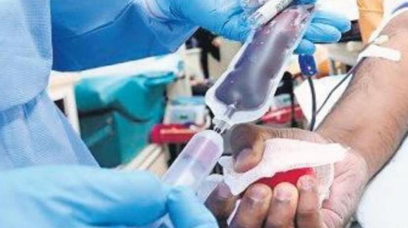 Plasma Therapy Plasma Therapy