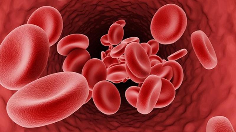 Thalassemia Thalassemia