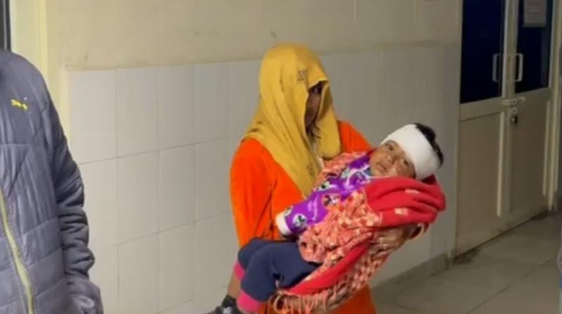 A dog attacked a 2-year-old child in Fazilka news in punjabi A dog attacked a 2-year-old child in Fazilka news in punjabi