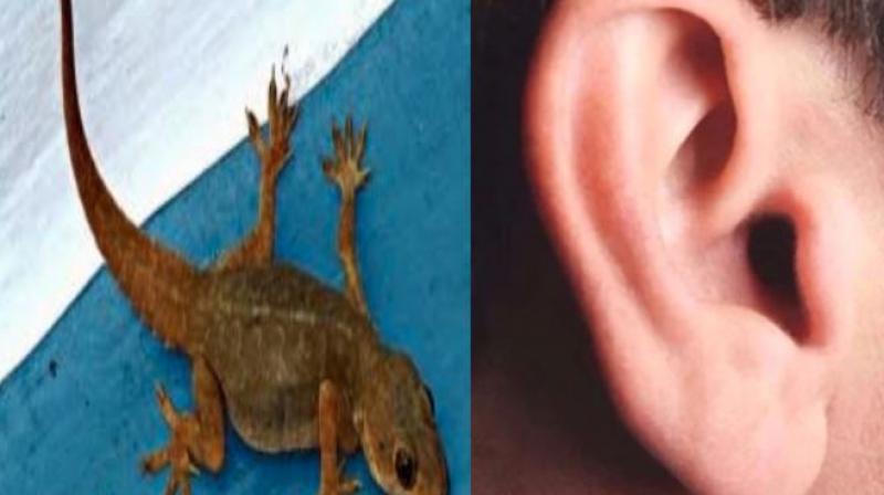 lizard come out in a 25 year old man ear in thailand