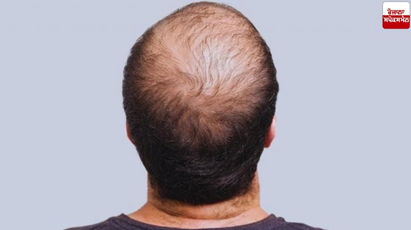 Hair Fall Health News