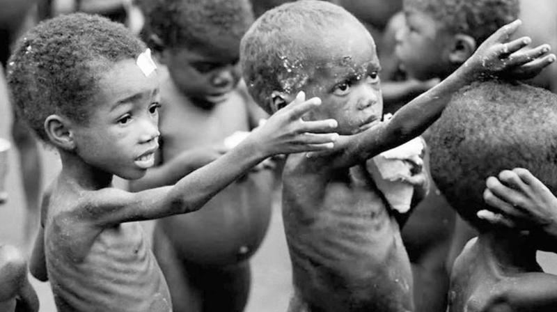 Malnutrition Malnutrition