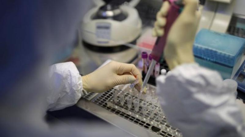 Three lakh more rapid antibody test kits for quick detection of the covid-19 Three lakh more rapid antibody test kits for quick detection of the covid-19