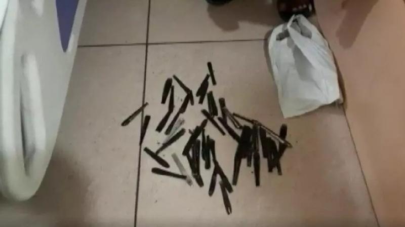 63 spoons came out of the young man's stomach, the young man was admitted to the drug addiction center for 5 months 63 spoons came out of the young man's stomach, the young man was admitted to the drug addiction center for 5 months