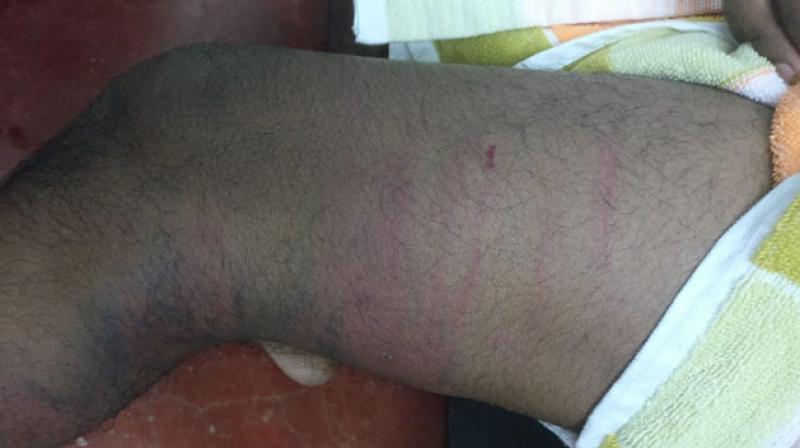 kerala student says seniors beaten me for 3 hours