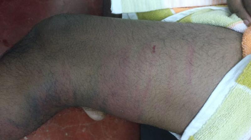 kerala student says seniors beaten me for 3 hours kerala student says seniors beaten me for 3 hours