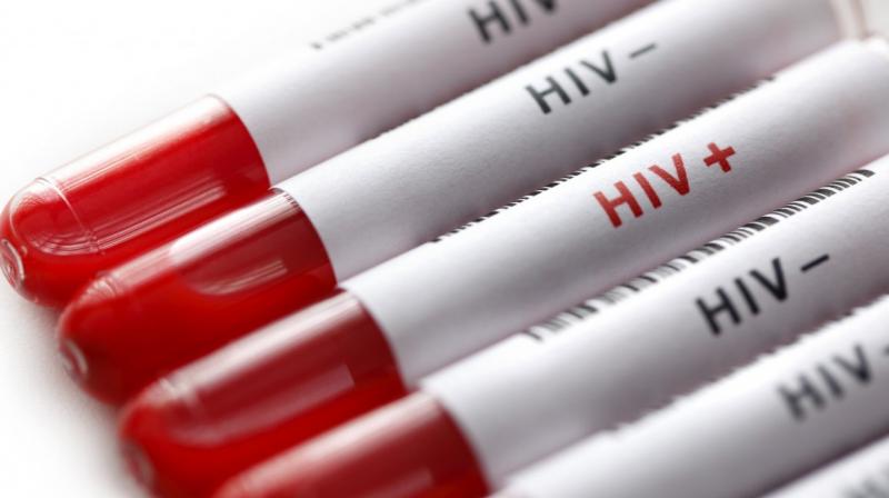 HIV has killed 2400 people in the last one year