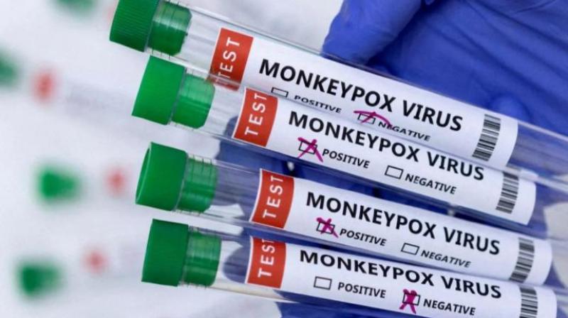 No Sexually Transmitted Infections Found In 5 Monkeypox Cases In Delhi: ICMR Study No Sexually Transmitted Infections Found In 5 Monkeypox Cases In Delhi: ICMR Study