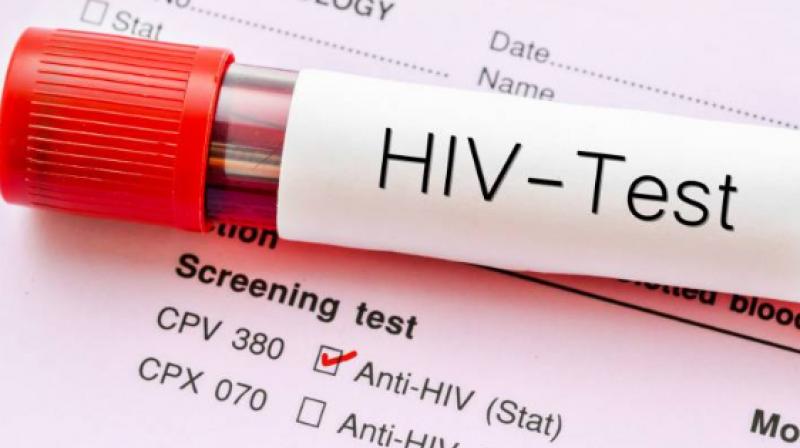 The second time the doctors performed the miracle by correcting the HIV victim The second time the doctors performed the miracle by correcting the HIV victim