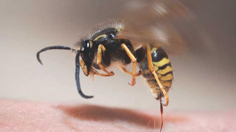 Man dies due to wasp sting Man dies due to wasp sting
