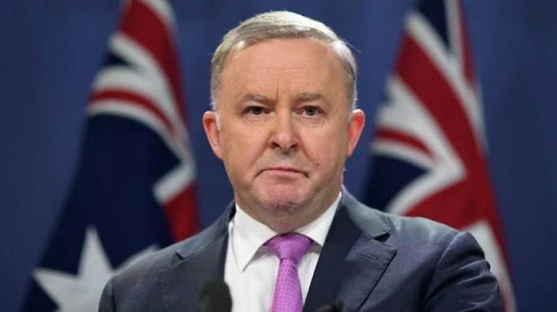 Anthony Albanese