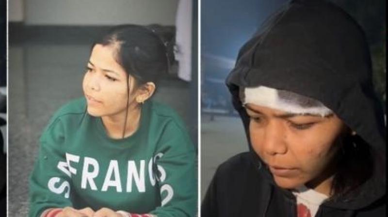 Attack on female social media influencer rajveer kaur with sharp weapons News in punjabi Attack on female social media influencer rajveer kaur with sharp weapons News in punjabi