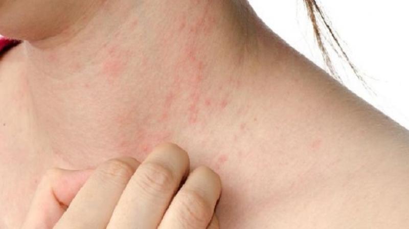 Try these recipes to get rid of bile problem in summer Try these recipes to get rid of bile problem in summer