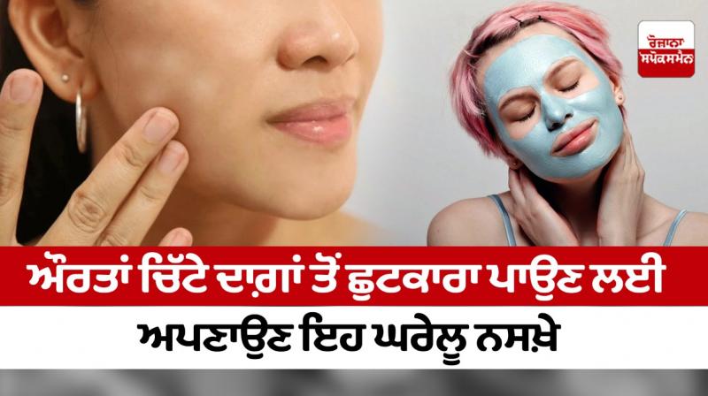 Women should adopt these home remedies to get rid of white spots Women should adopt these home remedies to get rid of white spots