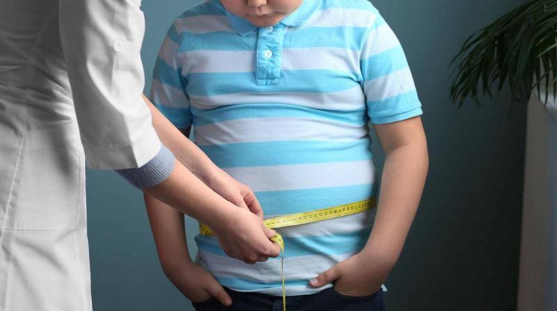 obesity obesity