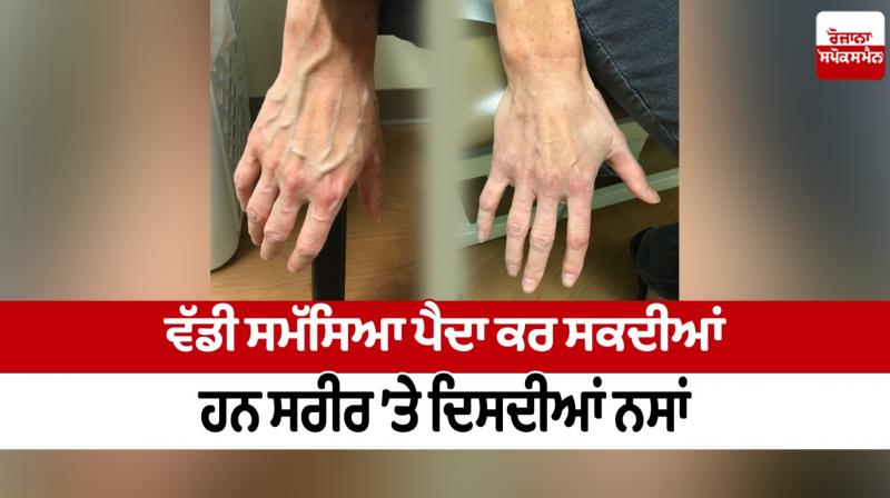 Nerves visible on body can cause a big problem Nerves visible on body can cause a big problem