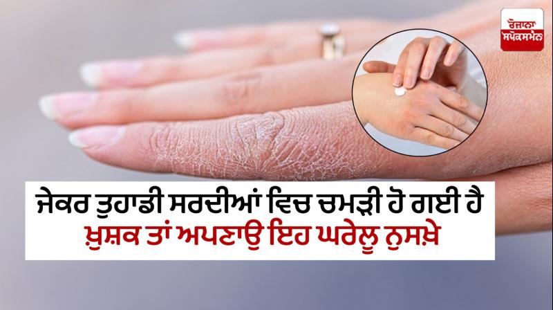 Skin has become dry in winter Skin has become dry in winter