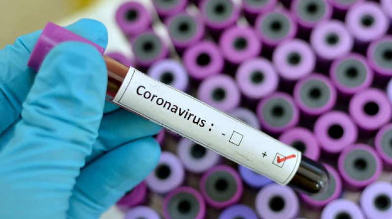 Corona Virus Corona Virus
