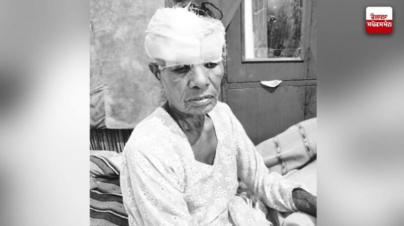 A stray dog attacked a woman who went to collect meat in the fields, she was seriously injured A stray dog attacked a woman who went to collect meat in the fields, she was seriously injured