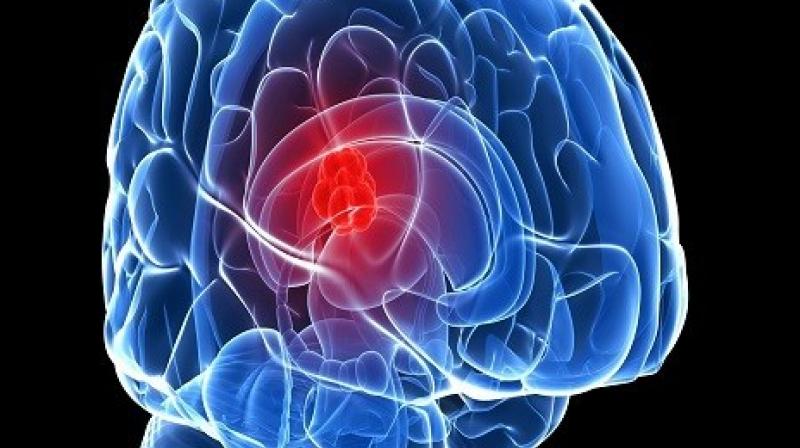 Internet use is changing your Brain Internet use is changing your Brain