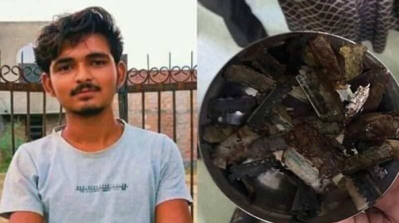 The young man swallowed 56 blades The young man swallowed 56 blades