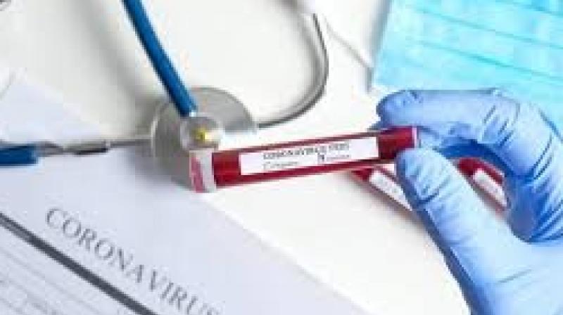 Corona Virus Corona Virus