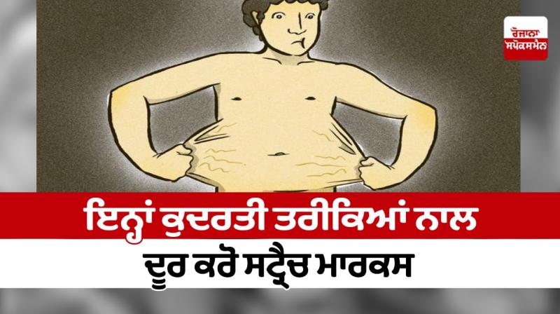Get rid of stretch marks with these natural methods Get rid of stretch marks with these natural methods