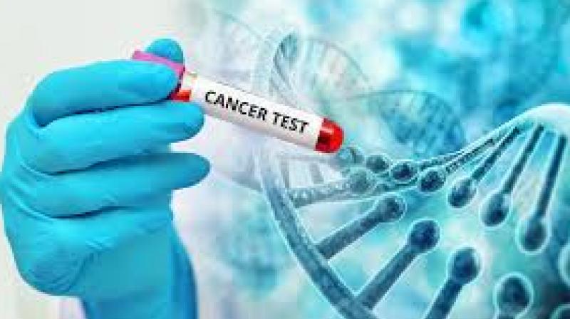 Cancer test Cancer test