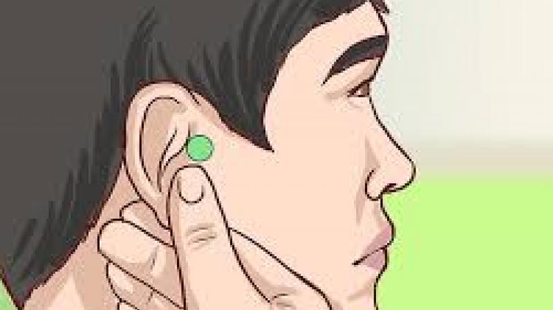 a point near the ear which is overcome by suppressing obesity a point near the ear which is overcome by suppressing obesity