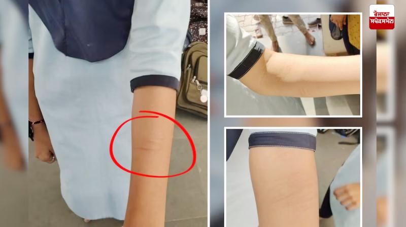 Gujarat: More than two dozen children injure themselves while playing 'dare game' Gujarat: More than two dozen children injure themselves while playing 'dare game'