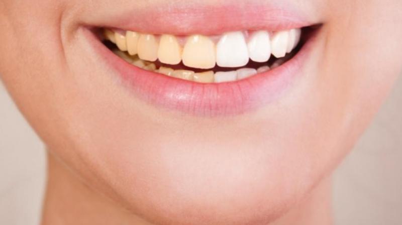  Turmeric can make yellow teeth white