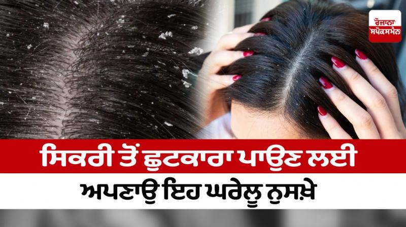 Dandruff Dandruff