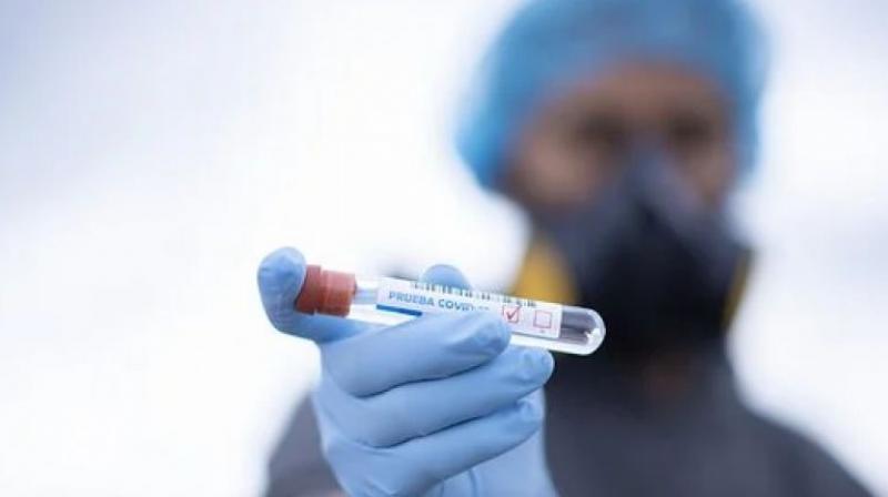 May brings back heat on coronavirus as trend shows reversal of gains made in april May brings back heat on coronavirus as trend shows reversal of gains made in april