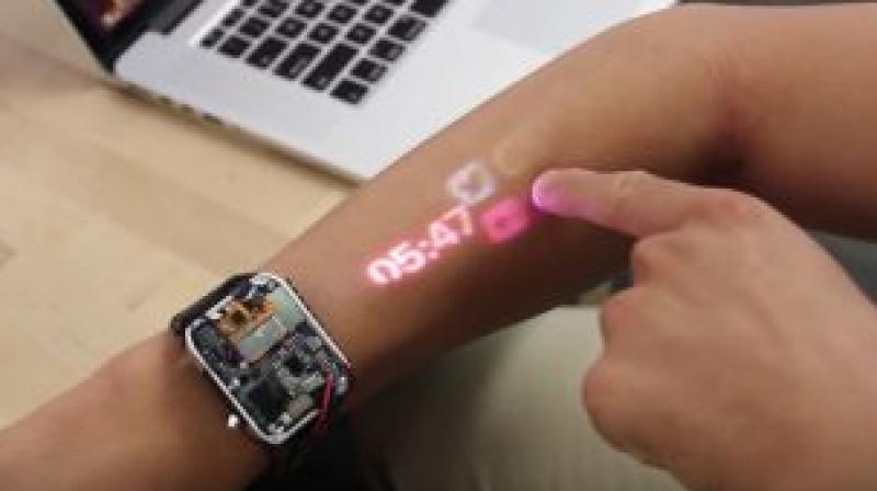 Smartwatch