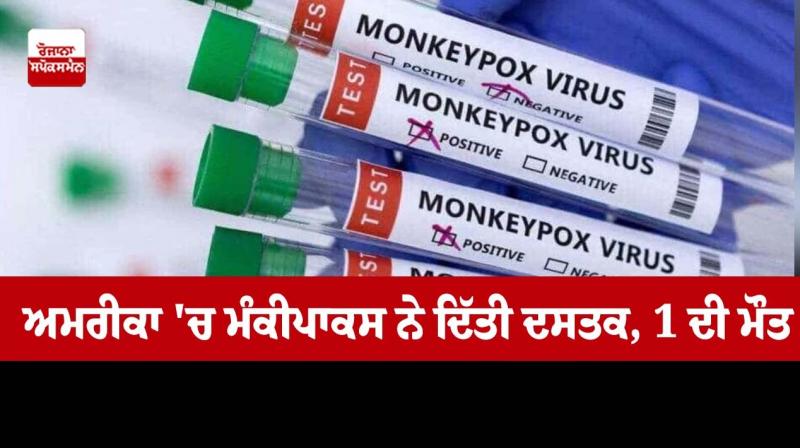 Monkeypox knocked in America Monkeypox knocked in America