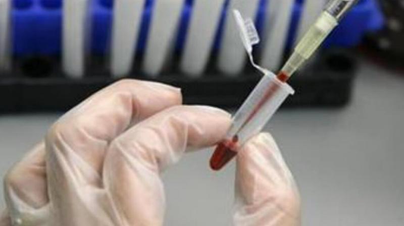 About 170 cases of hepatitis of unknown origin found in many countries, including Europe: WHO About 170 cases of hepatitis of unknown origin found in many countries, including Europe: WHO