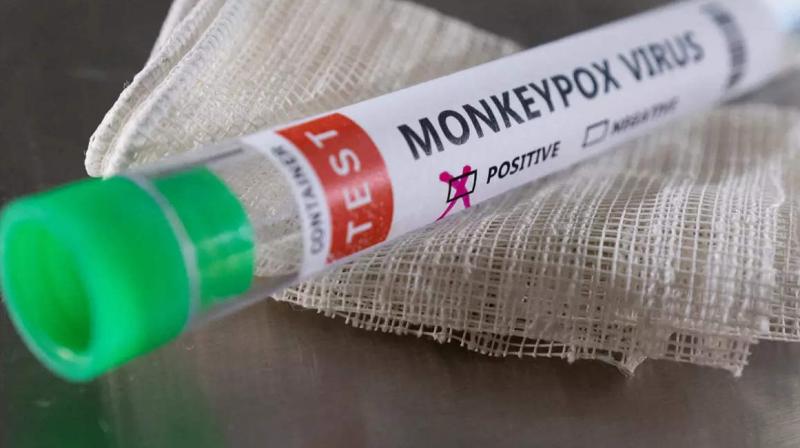 Monkeypox Monkeypox