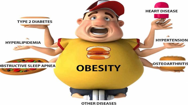 Obesity Obesity
