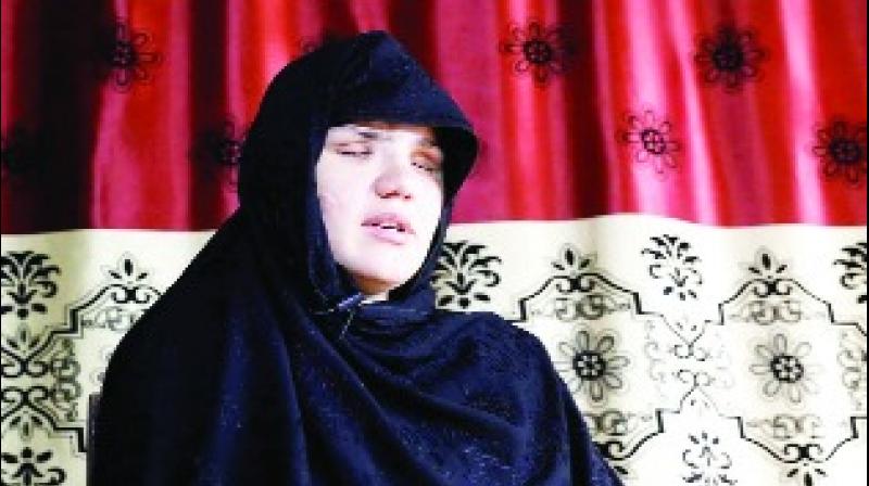 A woman escaped from Taliban Attack A woman escaped from Taliban Attack